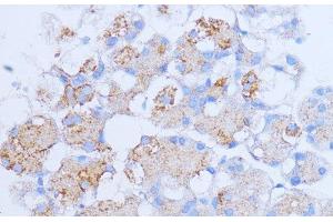 Immunohistochemistry of paraffin-embedded Rat pancreas using NME6 Polyclonal Antibody at dilution of 1:100 (40x lens). (NME6 anticorps)