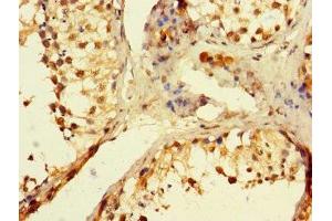 Immunohistochemistry of paraffin-embedded human testis tissue using ABIN7150223 at dilution of 1:100