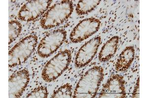 Immunoperoxidase of monoclonal antibody to SF1 on formalin-fixed paraffin-embedded human colon.