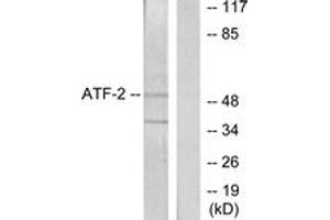 Western Blotting (WB) image for anti-Activating Transcription Factor 2 (ATF2) (AA 29-78) antibody (ABIN2888949) (ATF2 anticorps  (AA 29-78))