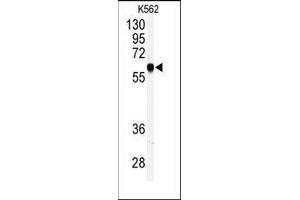 Western blot analysis of anti-PRKCABP Antibody (C-term) in K562 cell line lysates (35ug/lane). (PICK1 anticorps  (C-Term))