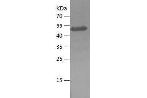 Western Blotting (WB) image for Melanoma Antigen Family C, 2 (MAGEC2) (AA 1-145) protein (His-IF2DI Tag) (ABIN7123899)