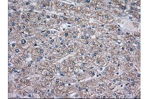 Immunohistochemical staining of paraffin-embedded Human liver tissue using anti-TBXAS1 mouse monoclonal antibody. (TBXAS1 anticorps)