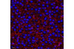 Immunofluorescence of paraffin embedded rat liver using THNSL2 (ABIN7075893) at dilution of 1: 400 (400x lens)