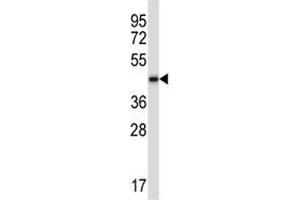 BMP2 antibody western blot analysis in CEM lysate.