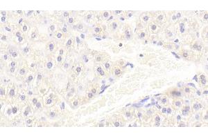 Detection of IBA1 in Mouse Liver Tissue using Polyclonal Antibody to Ionized Calcium-binding Adapter Molecule 1 (IBA1)