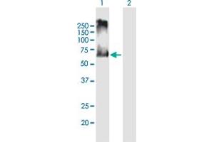Western Blot analysis of ACCN3 expression in transfected 293T cell line by ACCN3 MaxPab polyclonal antibody.