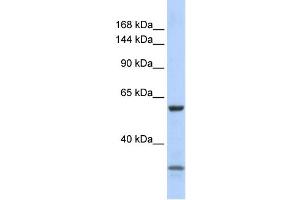 WB Suggested Anti-ZNF777 Antibody Titration:  0. (ZNF777 anticorps  (N-Term))
