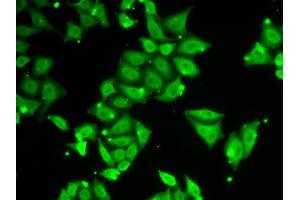 Immunofluorescence analysis of HeLa cells using ATXN3 antibody. (Ataxin 3 anticorps)