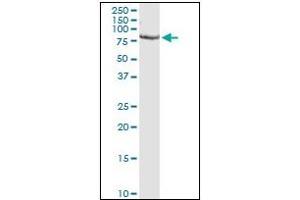 Western Blotting (WB) image for anti-Proprotein Convertase Subtilisin/kexin Type 1 (PCSK1) (AA 652-754) antibody (ABIN781869)