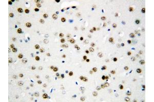 Anti-Apoptosis inhibitor 5 antibody, IHC(P) IHC(P): Rat Brain Tissue