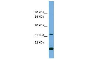 CTDSP2 antibody used at 1 ug/ml to detect target protein. (CTDSP2 anticorps)