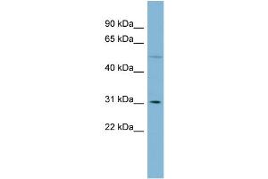 WB Suggested Anti-MRPL28  Antibody Titration: 0. (MRPL28 anticorps  (Middle Region))