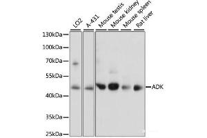 Western blot analysis of extracts of various cell lines using ADK Polyclonal Antibody at dilution of 1:1000. (ADK anticorps)
