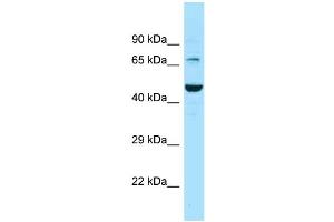 Western Blotting (WB) image for anti-Solute Carrier Family 6 (Neurotransmitter Transporter, GABA), Member 11 (SLC6A11) (C-Term) antibody (ABIN2788129) (SLC6A11 anticorps  (C-Term))