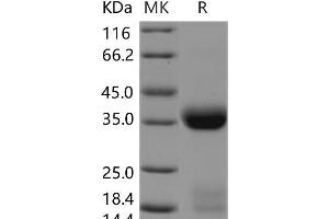 Western Blotting (WB) image for Kallikrein 1 (KLK1) (Active) protein (His tag) (ABIN7196656)