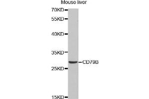 Western Blotting (WB) image for anti-CD79b Molecule, Immunoglobulin-Associated beta (CD79B) (AA 29-159) antibody (ABIN6219206) (CD79b anticorps  (AA 29-159))