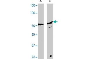 Western blot analysis of RHOBTB2 polyclonal antibody  expression in Hela (A) and A-431 (B) whole cell lysates. (RHOBTB2 anticorps  (C-Term))