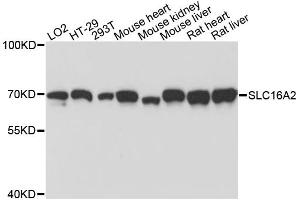 Western blot analysis of extracts of various cell lines, using SLC16A2 antibody. (SLC16A2/MCT8 anticorps)