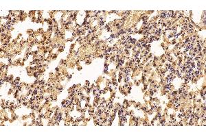 Detection of IFNa2 in Rat Lung Tissue using Polyclonal Antibody to Interferon Alpha 2 (IFNa2)