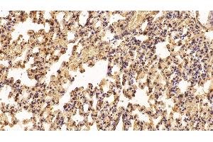 Detection of IFNa2 in Rat Lung Tissue using Polyclonal Antibody to Interferon Alpha 2 (IFNa2) (IFNA2 anticorps  (AA 24-188))