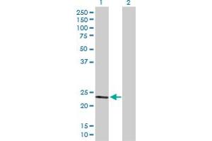 Western Blot analysis of SOD2 expression in transfected 293T cell line by SOD2 MaxPab polyclonal antibody. (SOD2 anticorps  (AA 1-222))