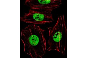 Fluorescent image of Hela cells stained with (Mouse) Smarcc1 Antibody (C-term) (ABIN6242636 and ABIN6577666). (SMARCC1 anticorps  (C-Term))