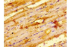 anti-Integrin-Linked Kinase (ILK) (AA 1-228) antibody