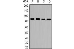 Western blot analysis of ZNF839 expression in HeLa (A), MCF7 (B), RAW264. (ZNF839 anticorps)