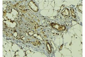 ABIN6278698 at 1/100 staining Human lung tissue by IHC-P. (GLI3 anticorps  (Internal Region))