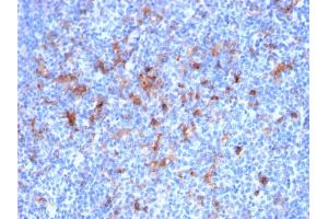 Formalin-fixed, paraffin-embedded human Tonsil stained with CD25 Mouse Monoclonal Antibody (IL2RA/2395).