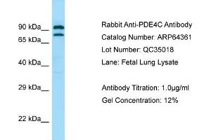 Western Blotting (WB) image for anti-phosphodiesterase 4C, CAMP-Specific (PDE4C) (C-Term) antibody (ABIN2789817)