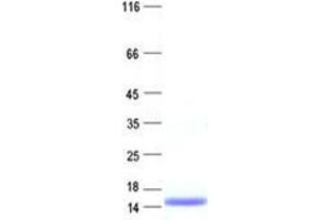 Validation with Western Blot (SPINK8 Protein (His tag))
