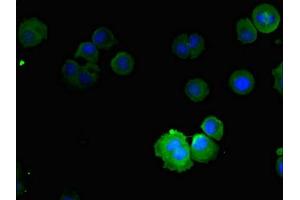 Immunofluorescent analysis of MCF-7 cells using ABIN7161014 at dilution of 1:100 and Alexa Fluor 488-congugated AffiniPure Goat Anti-Rabbit IgG(H+L) (NOX5 anticorps  (AA 661-765))
