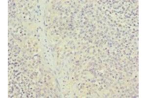 Immunohistochemistry of paraffin-embedded human tonsil tissue using ABIN7161949 at dilution of 1:100 (NUTF2 anticorps  (AA 1-127))
