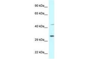 Image no. 1 for anti-Bone Marrow Stromal Cell Antigen 1 (BST1) (AA 108-157) antibody (ABIN6747338) (BST1 anticorps  (AA 108-157))