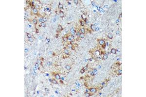Immunohistochemistry of paraffin-embedded Mouse brain using GRSF1 Rabbit pAb (ABIN7267319) at dilution of 1:100 (40x lens). (GRSF1 anticorps)
