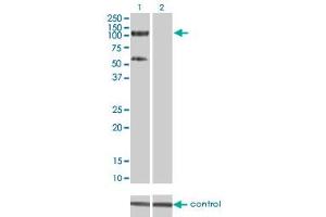 Western blot analysis of TRIM28 over-expressed 293 cell line, cotransfected with TRIM28 Validated Chimera RNAi (Lane 2) or non-transfected control (Lane 1). (KAP1 anticorps  (AA 379-524))