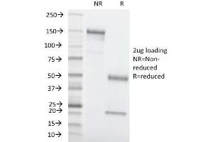 SDS-PAGE Analysis Purified CEA Mouse Monoclonal Antibody (C66/1260). (CEACAM5 anticorps)