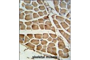 Formalin-fixed and paraffin-embedded human skeletal muscle tissue reacted with CARD4 Antibody (C-term), which was peroxidase-conjugated to the secondary antibody, followed by DAB staining.