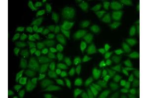 Immunofluorescence analysis of A549 cells using KPNA1 antibody.