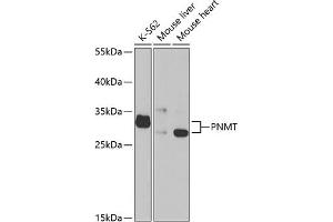 Western blot analysis of extracts of various cell lines, using PNMT antibody (ABIN6130644, ABIN6145848, ABIN6145850 and ABIN6221200) at 1:1000 dilution. (PNMT anticorps  (AA 1-282))