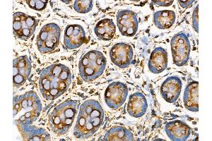ABIN6258534 and ABIN6274806 at 1/100 staining Rat stomach tissue by IHC-P. (ACOT4 anticorps  (C-Term))