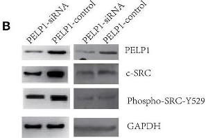 PELP1 knockdown downregulated c-Src-PI3K-Erk pathway. (Src anticorps  (pTyr529))