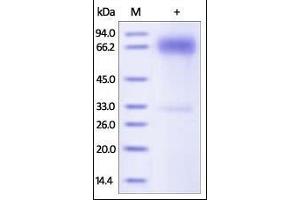 Mouse PD-L1, Fc Tag on SDS-PAGE under reducing (R) condition. (PD-L1 Protein (AA 19-238) (Fc Tag))