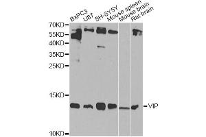 Western blot analysis of extracts of various cell lines, using VIP Antibody (ABIN5970913) at 1/1000 dilution. (Vip anticorps)