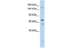 WB Suggested Anti-GRIN2B Antibody Titration:  0. (GRIN2B anticorps  (Middle Region))