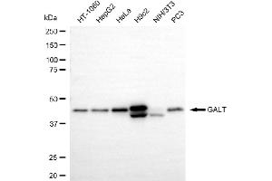 Western blotting analysis using GALT antibody (ABIN7798682). (Recombinant GALT anticorps)