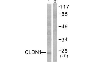 Western blot analysis of extracts from HeLa cells, using Claudin 1 antibody (#C0142). (Claudin 1 anticorps)