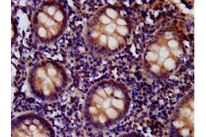 IHC image of ABIN7147205 diluted at 1:400 and staining in paraffin-embedded human appendix tissue performed on a Leica BondTM system.